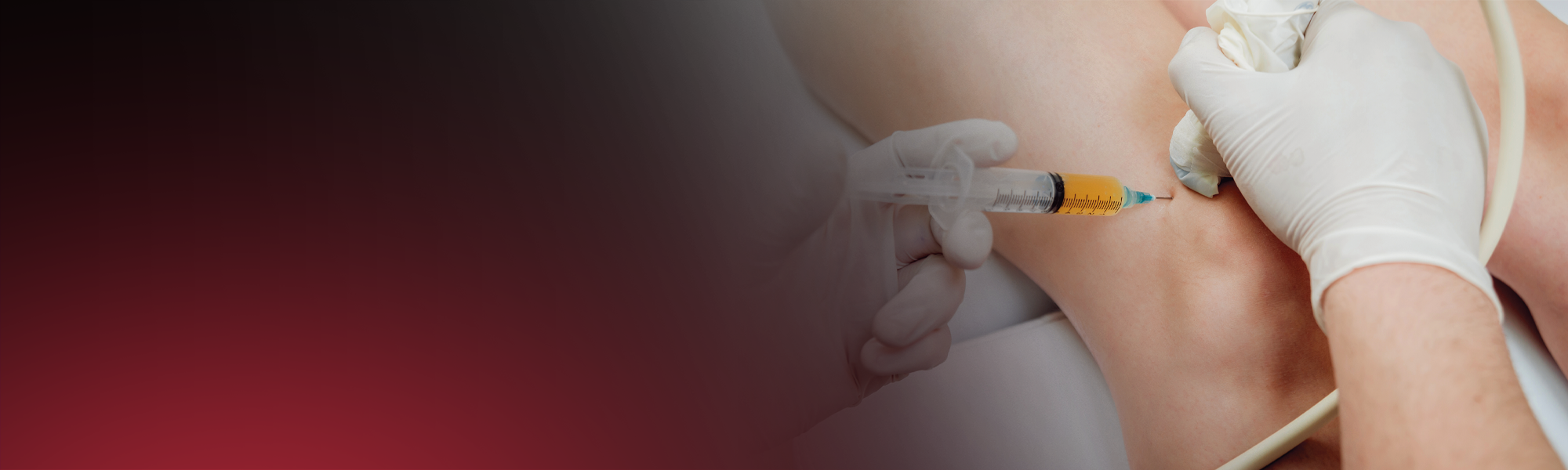 Platelet Rich Plasma PRP Injections South East Radiology Platelet rich plasma prp injections south east radiology